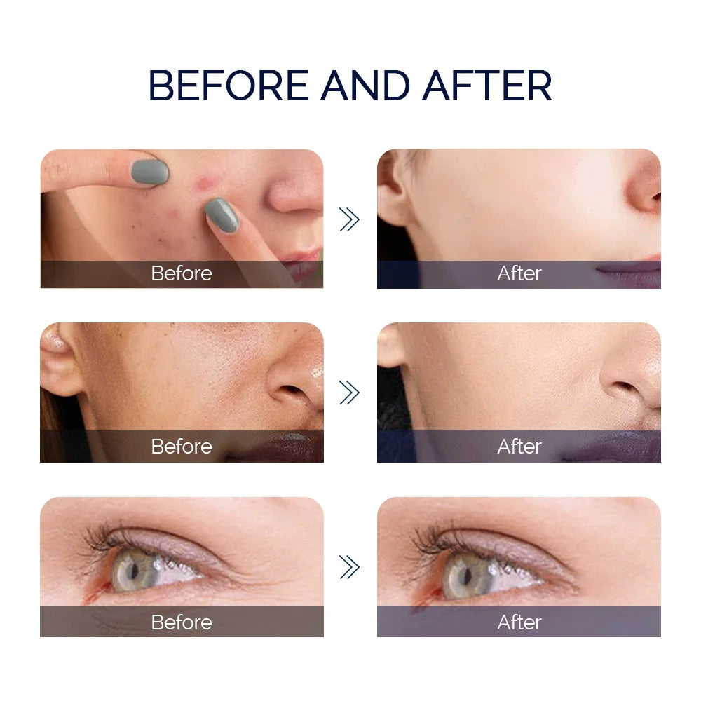 Gold Glow Nano Misting Comprehensive Facial Spa with 7 Light Color Therapies